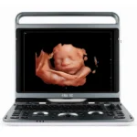 Ultrasonido Chison EBit 50