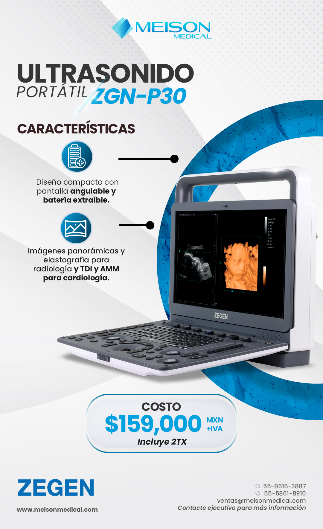 Ultrasonido-p30