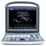 Ultrasonido Portátil de Alta Precisión ECO 2+