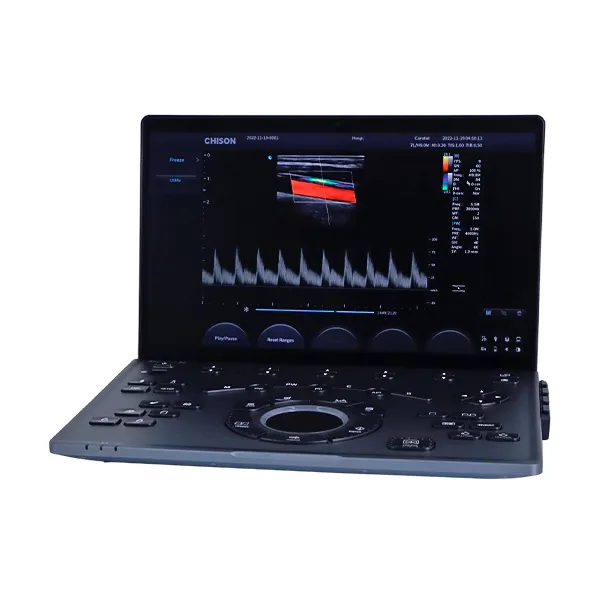 Ultrasonido Portátil Sonoair-30 con diseño delgado