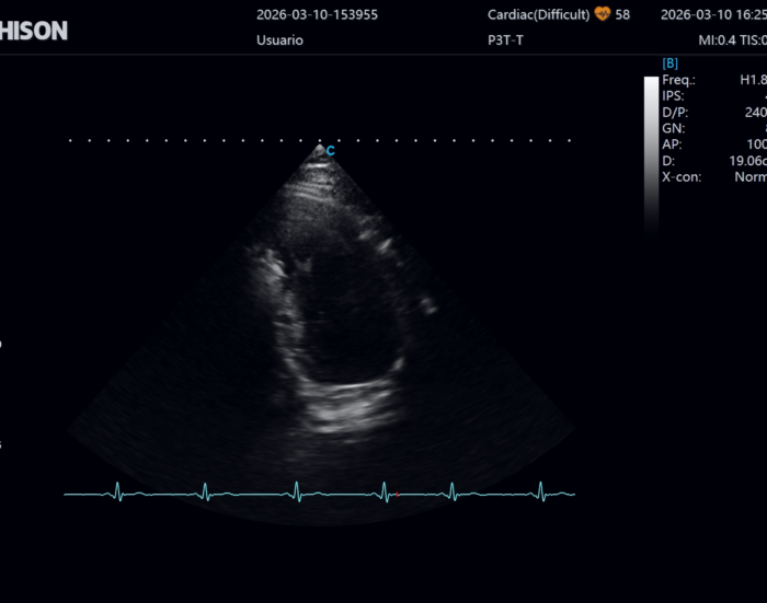 la nueva generación de ultrasonidos